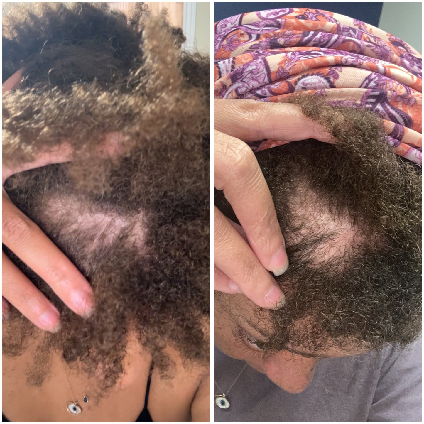 Essence- Light Hair Growth Oil with Amla, Pumpkin, Fenugreek, Chebe, Jojoba & More