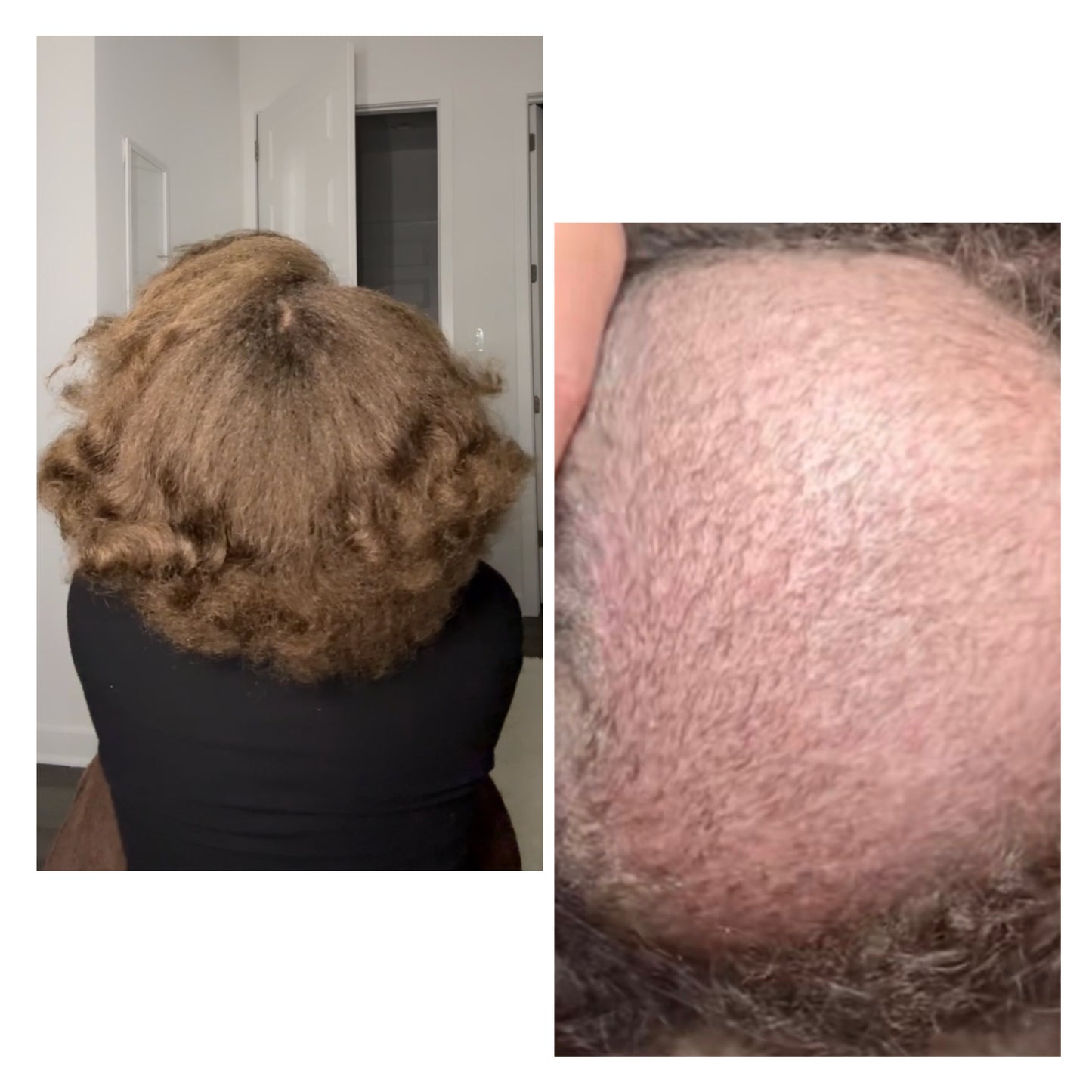 Soothe - Ayurvedic Hair Growth Oil (EXTRA STRENGTH) with Fenugreek, Black Seed, Amla, Rosemary, Chebe, Argan & More