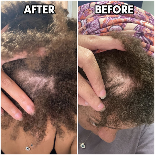 Essence- LIGHT Ayurvedic Hair Growth Oil with Amla, Pumpkin, Fenugreek, Chebe, Jojoba & More