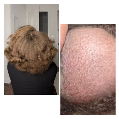 Soothe - Ayurvedic Hair Growth Oil (EXTRA STRENGTH) with Fenugreek, Black Seed, Amla, Rosemary, Chebe, Argan & More