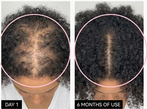Soothe - Hair Growth Oil with Fenugreek, Black Seed, Amla, Rosemary, Chebe, Argan & More